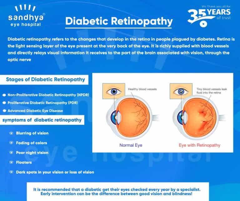 Diabetic Retinopathy - Sandhya Eye Hospitals