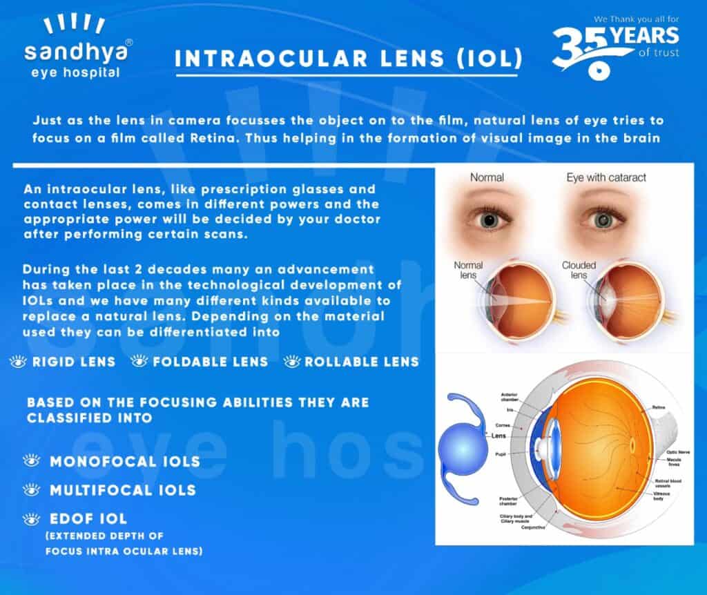 Intraocular Lens IOL Sandhya Eye Hospitals